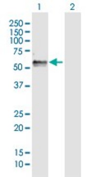 Anti-FAM134B antibody produced in rabbit