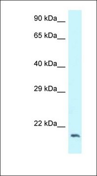 Anti-DCTN3 antibody produced in rabbit