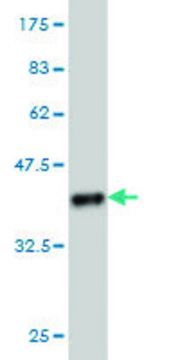 ANTI-PRKCD antibody produced in mouse