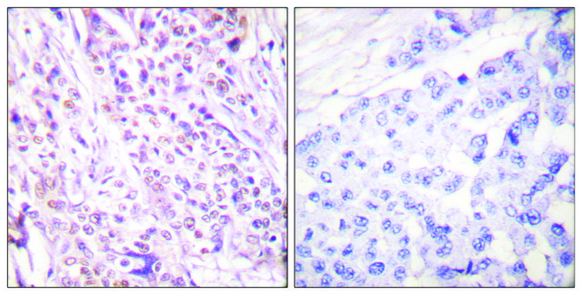 Anti-RAD17 antibody produced in rabbit