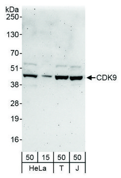 Rabbit anti-CDK9 Antibody, Affinity Purified