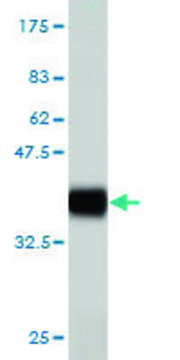Monoclonal Anti-ADAM2 antibody produced in