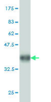 ANTI-KIT antibody produced in mouse