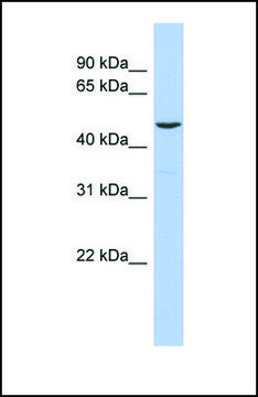 Anti-FLI1 antibody produced in rabbit