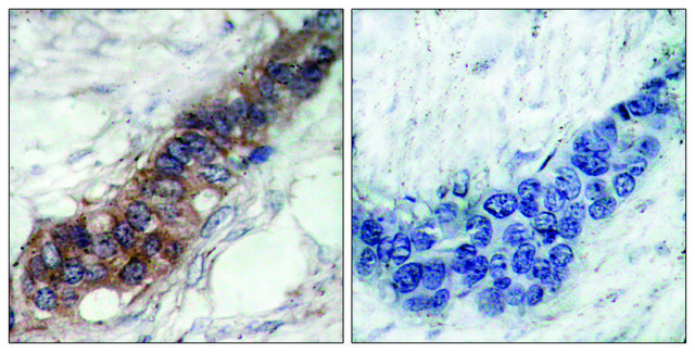 Anti-JAK2 antibody produced in rabbit