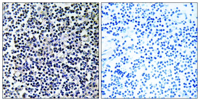 Anti-TACC3 antibody produced in rabbit