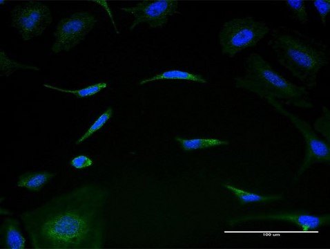 Monoclonal Anti-MRPL1 antibody produced in