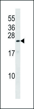 ANTI-ZN673 (C-TERM) antibody produced in
