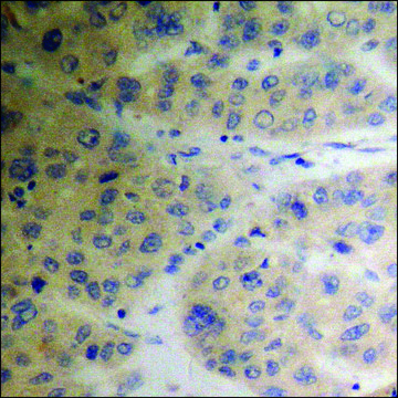 Anti-phospho-TIP60 (pSer??) antibody produced in