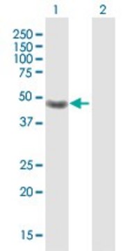 Anti-CRELD1 antibody produced in rabbit