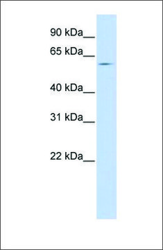 Anti-SLC15A4 antibody produced in rabbit