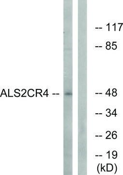 Anti-ALS2CR4 antibody produced in rabbit