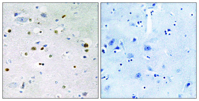 Anti-ZNF7, N-Terminal antibody produced in