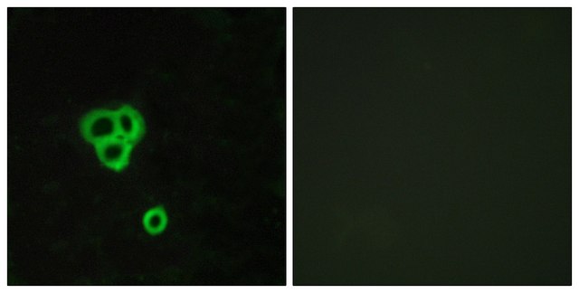 Anti-GPR119 antibody produced in rabbit
