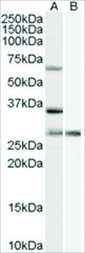 Anti-PRPF31 antibody produced in goat