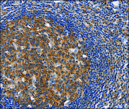 Anti-CEP97 antibody produced in rabbit
