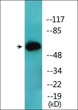 Anti-phospho-Lck (pTyr³?³) antibody produced in