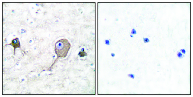 Anti-NSE antibody produced in rabbit