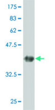 ANTI-GUCY2C antibody produced in mouse