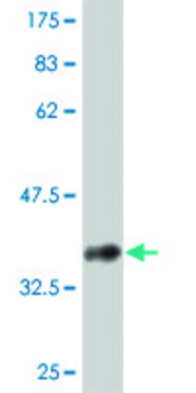 ANTI-ABL2 antibody produced in mouse
