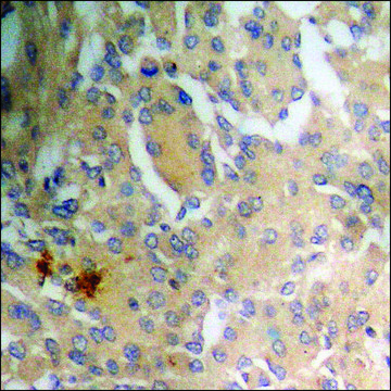 Anti-phospho-NFAT3 (pSer???) antibody produced in