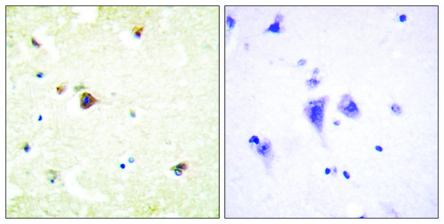 Anti-TRIM3 antibody produced in rabbit