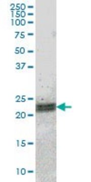 ANTI-ATF3 antibody produced in mouse