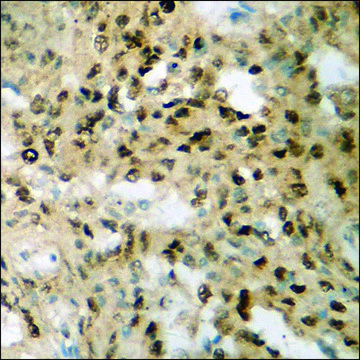 Anti-phospho-S6 Ribosomal Protein (pSer²³?) antibody