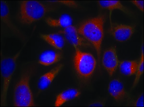 Anti-MRCL3 (Ab-18) antibody produced in