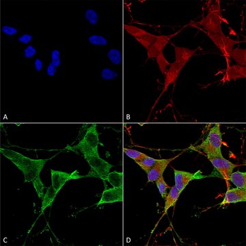 Monoclonal Anti-Lrrk2/Dardarin antibody produced in