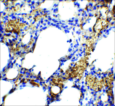 Anti-TM4SF1 antibody produced in rabbit