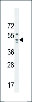 ANTI-C10ORF47 (N-TERM) antibody produced in