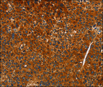 Anti-CDK19 antibody produced in rabbit