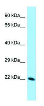 Anti-CDNF (N-terminal) antibody produced in