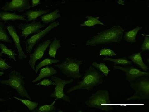 Anti-TPRKB antibody produced in rabbit