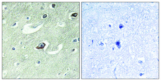 Anti-KIF20A antibody produced in rabbit