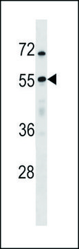 ANTI-USP27X (N-TERM) antibody produced in