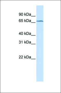 Anti-TRMT5 antibody produced in rabbit