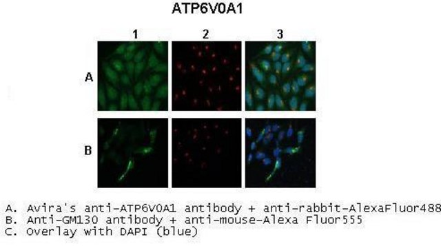 Anti-ATP6V0A1, (C-terminal) antibody produced in
