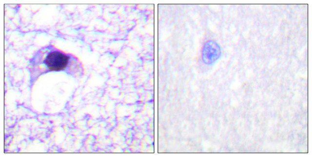 Anti-E2F6 antibody produced in rabbit