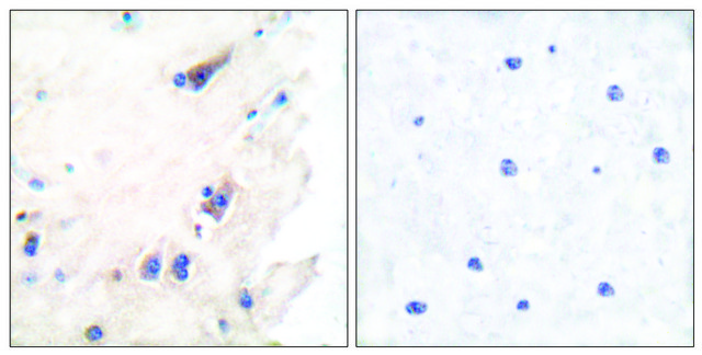 Anti-PLCB3 antibody produced in rabbit