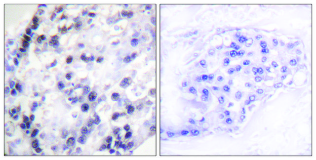 Anti-HNRNP C1 antibody produced in