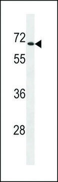 ANTI-UGT2B28 (CENTER) antibody produced in