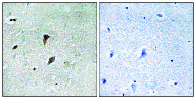 Anti-phospho-MAP2K3 (pThr²²²) antibody produced in