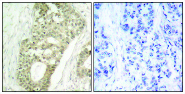 Anti-phospho-PRKCD (pSer???) antibody produced in