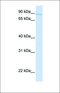 Anti-TBX2 antibody produced in rabbit