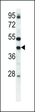 ANTI-CONNEXIN 37(C-TERMINAL) antibody produced in