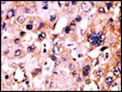 Anti-PSKH1 (C-term) antibody produced in