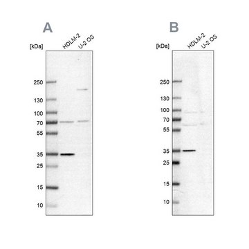 Anti-TTC19 antibody produced in rabbit