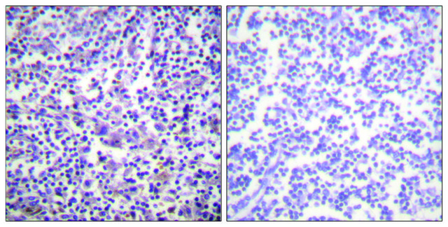 Anti-B-RAF, C-Terminal antibody produced in